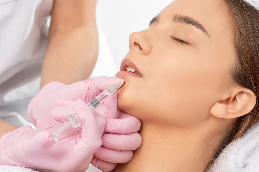Hyaluron-Filler · Lippen · Behandlung